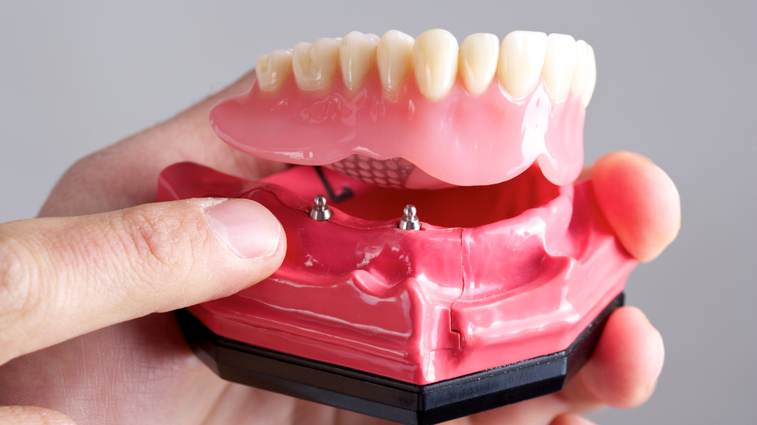 dentures at key dental clinic downtown vancouver