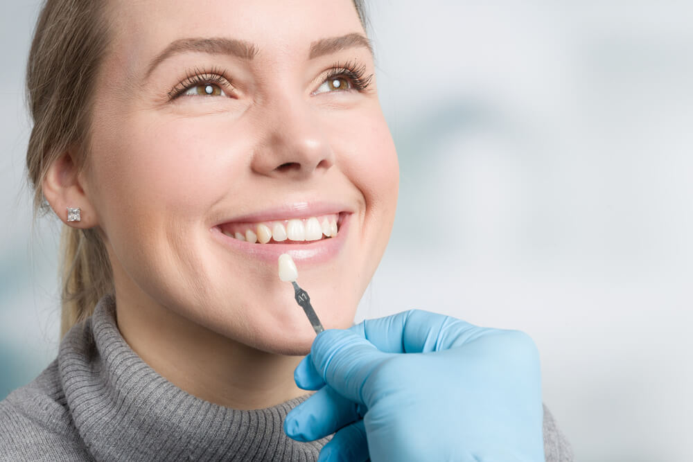 Tips To Maintain Your Dental Veneers