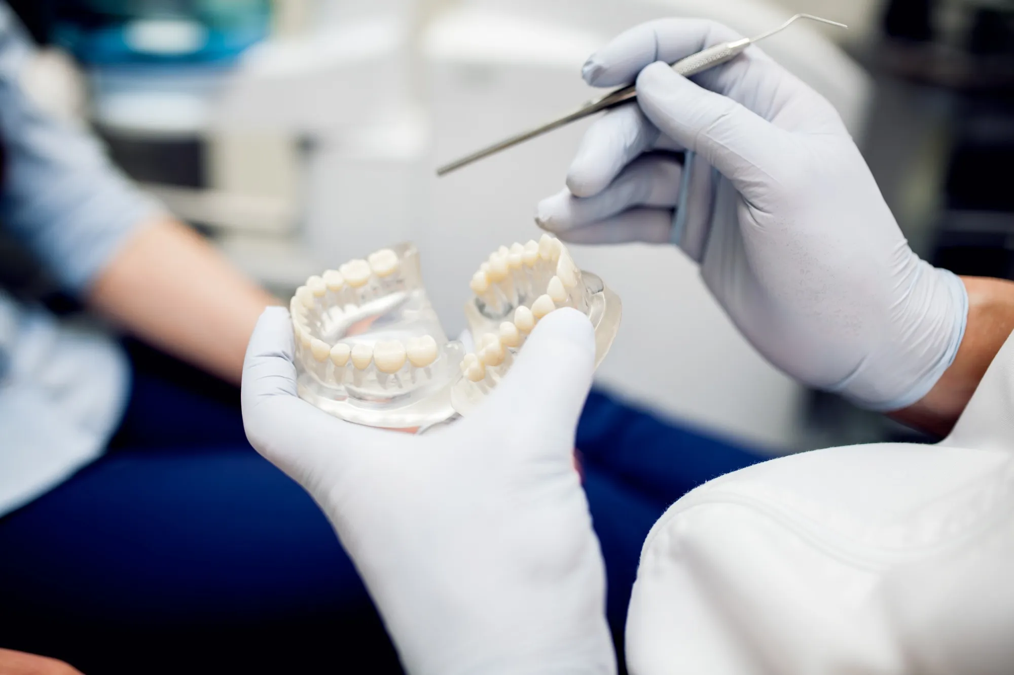 Types of Dental Crowns: Porcelain, Metal, and Zirconia